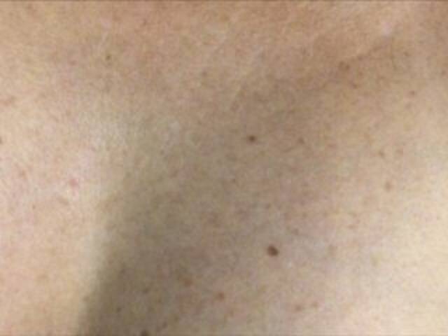 Kringkasting av skjermbilder Alianakiss